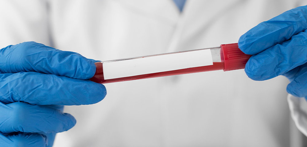 Servicio Dermoconsejo Farmacia Santa Teresa Sant Cugat del Vallès