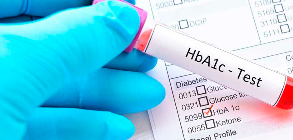 Servicio Dermoconsejo Farmacia Santa Teresa Sant Cugat del Vallès